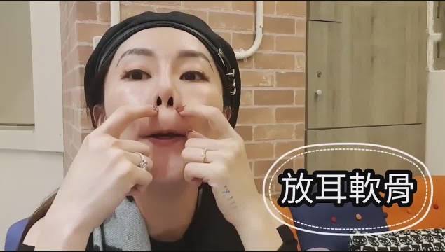 蒜头鼻美女 接受不了 隆鼻后告别蒜头鼻 只能叫美女 蒜头鼻美女 接受不了 隆鼻后告别蒜头鼻 只能叫美女