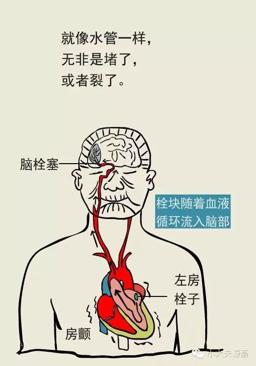 来源:崖州区卫健委,小大夫漫画编辑:苏文文审核:袁纯玉,赖丹丹特别