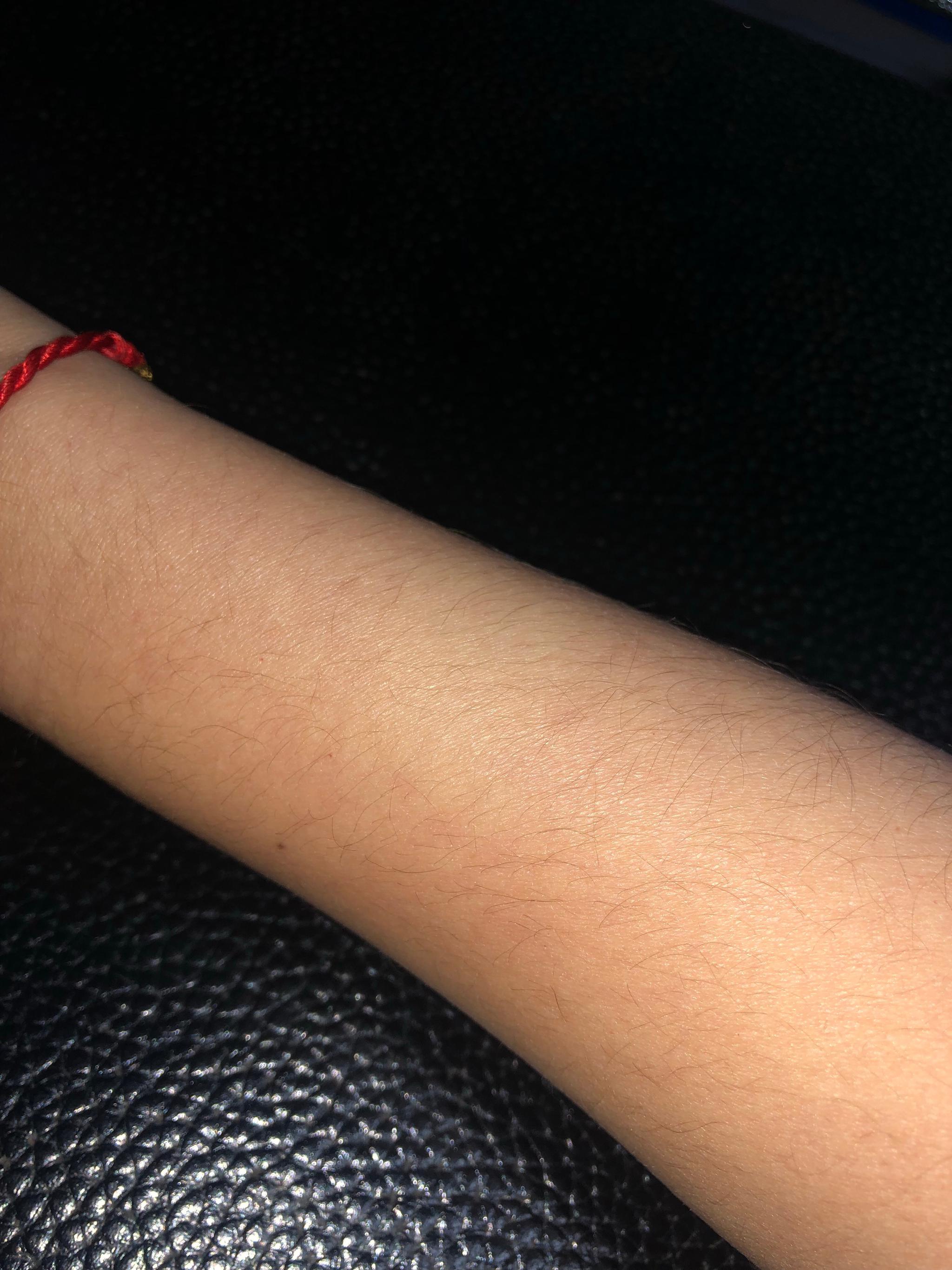 用了一段时间烟酰胺身体乳的手毛反馈.