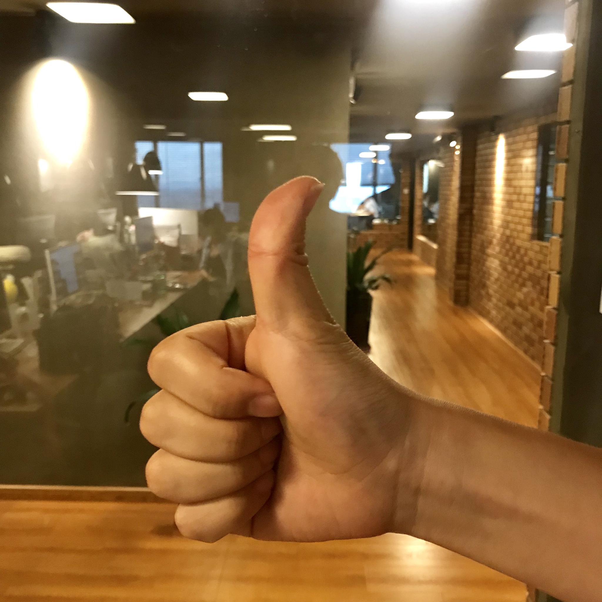 好可怕,大家的大拇指都能这么弯吗?为啥俺不行