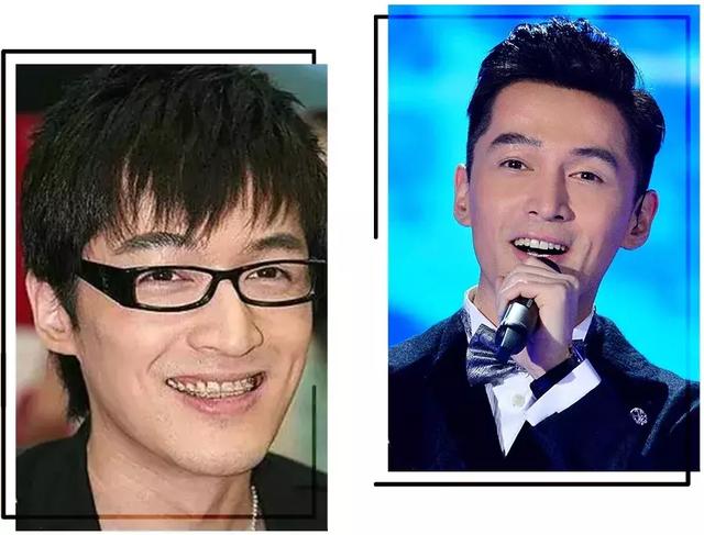 牙齿|林允|牙套_新浪新闻