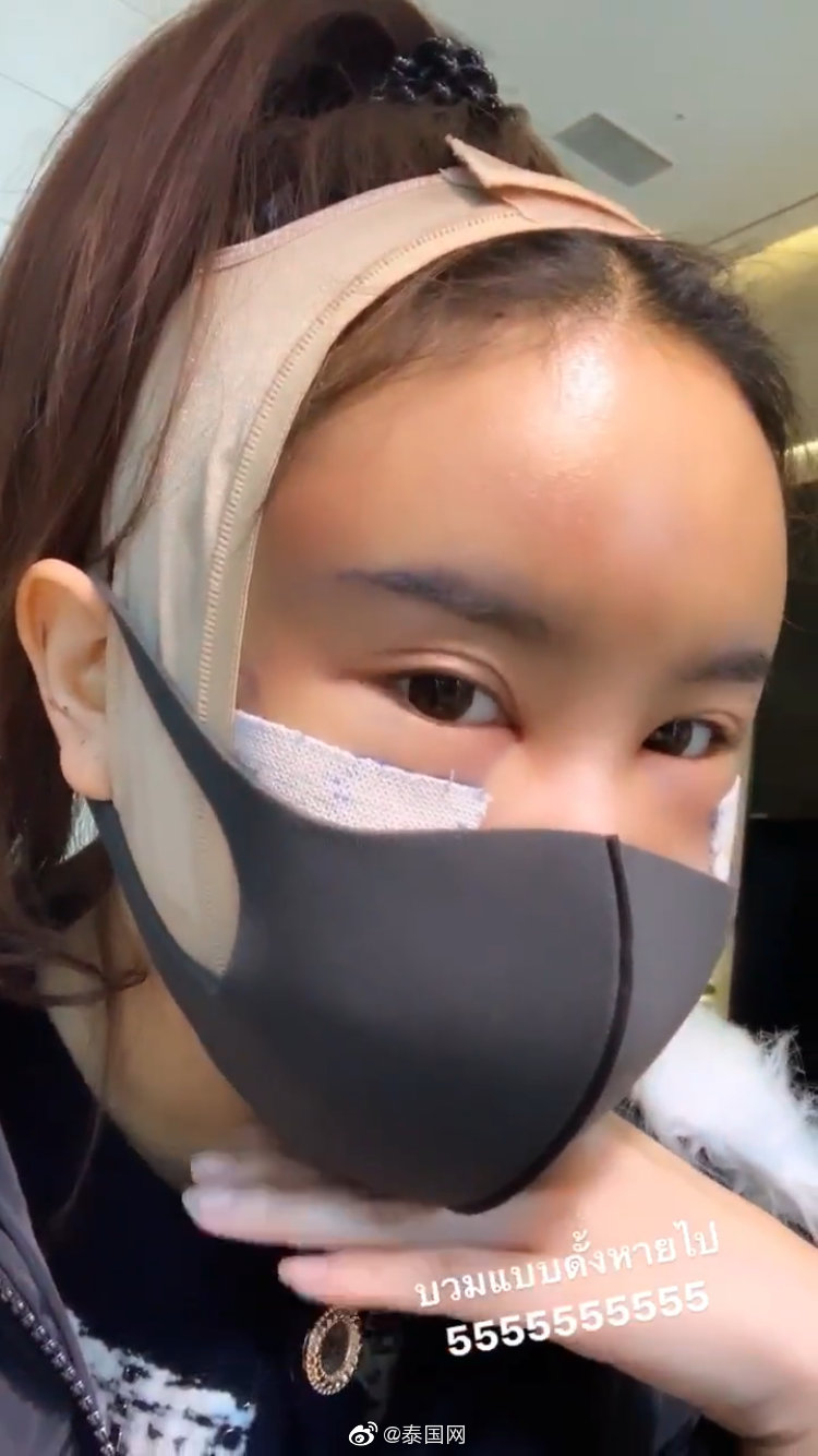 泰星captain前女友赴韩整形术后照判若两人