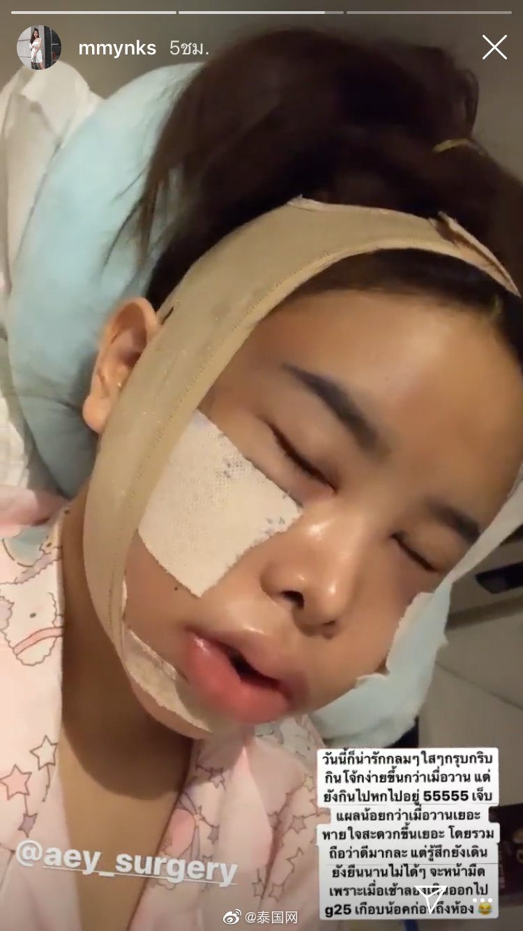 泰星captain前女友赴韩整形术后照判若两人