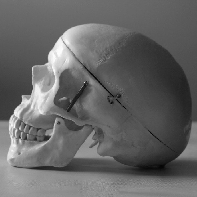 各个角度的头骨参考