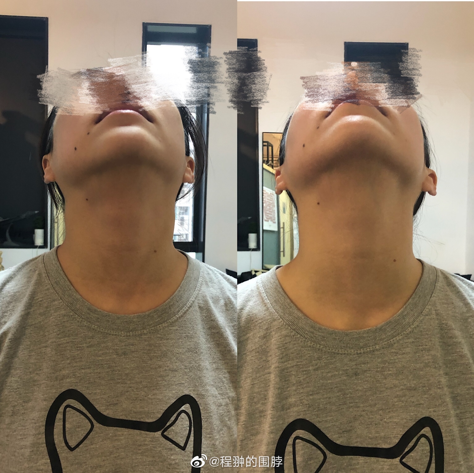 下颌歪斜脊柱侧弯长短腿呼吸不顺畅在一个人身上一站式解决