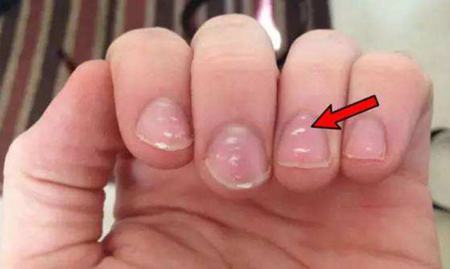 3-6岁孩子缺锌,身体会出现这4个症状!严重的会影响孩子身体发育