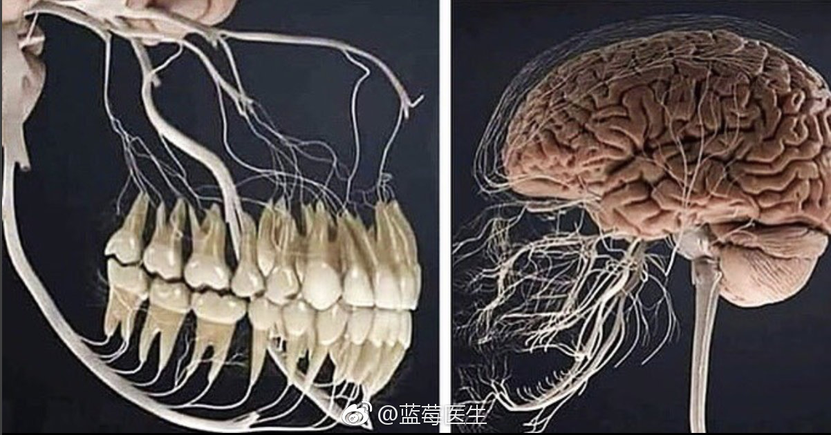 谁说牙疼不是病?疼起来真要命!三叉神经的两个分支连接到每个牙根