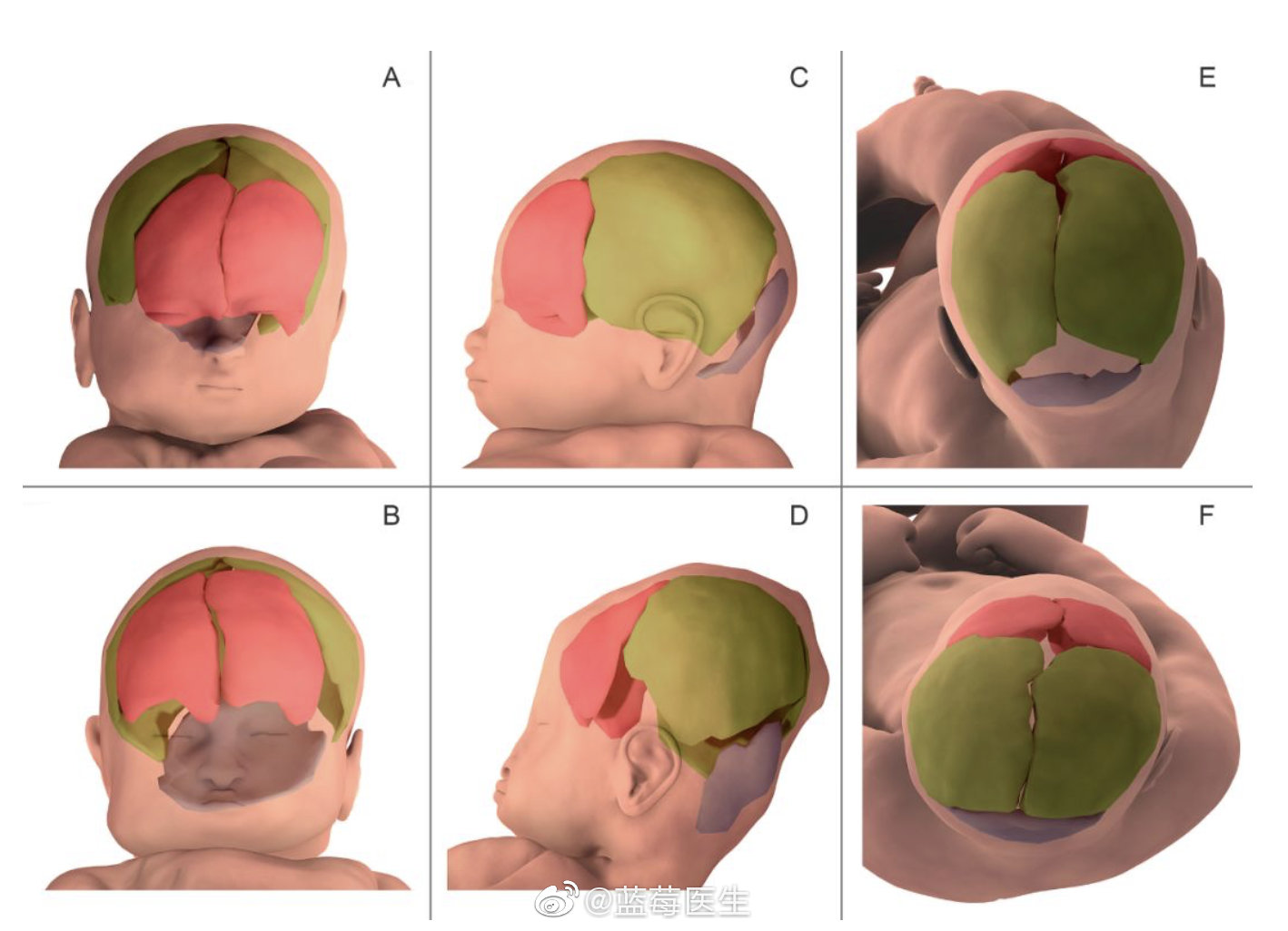 宝宝们真的很努力了|产道|婴儿|头骨_新浪新闻