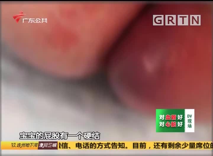 (dv现场)家长求助:婴儿住月子中心被电梯撞头 还患上肛周脓肿