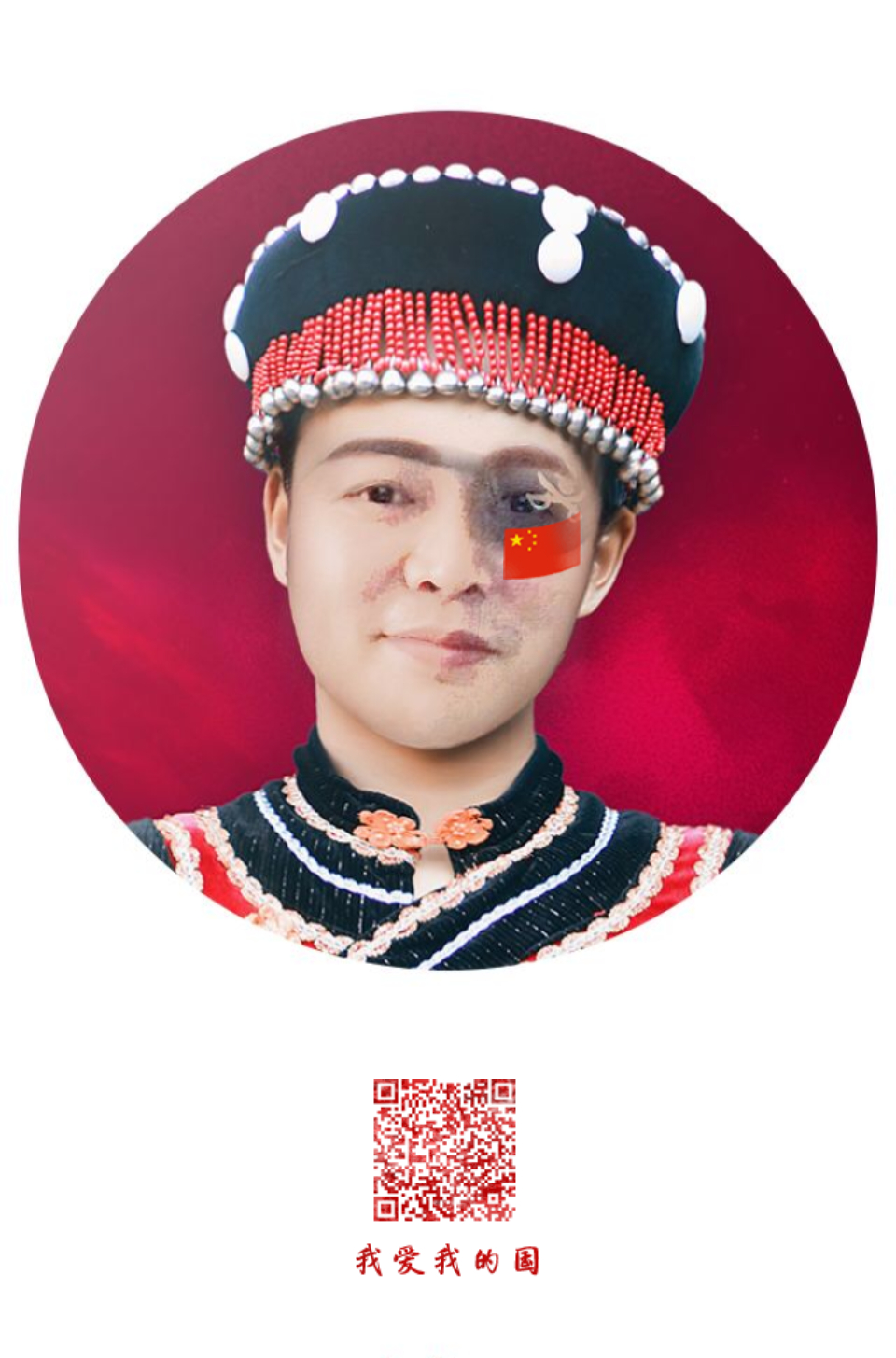 一个独眼人和完全的瞎子比起来,缺点更为严重|独眼|瞎子|缺点_新浪新闻