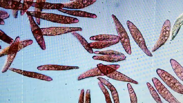 显微镜下的世界:纤毛虫无性别的配对.