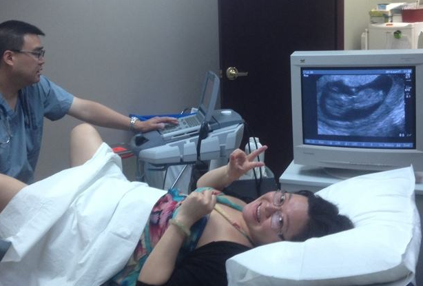在怀孕初期的时候检查胎芽胎心,当时被要求做阴超,而且还是一个男医生