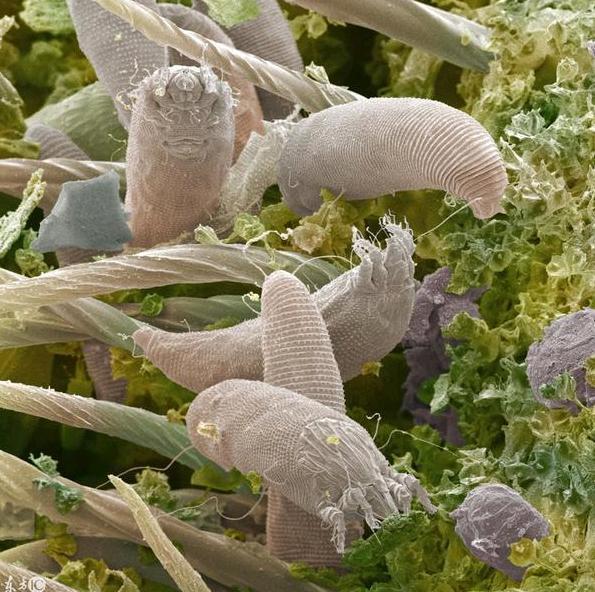 毛孔里堆积了整个蠕形螨,怎么排出来?后悔知道的太晚了!