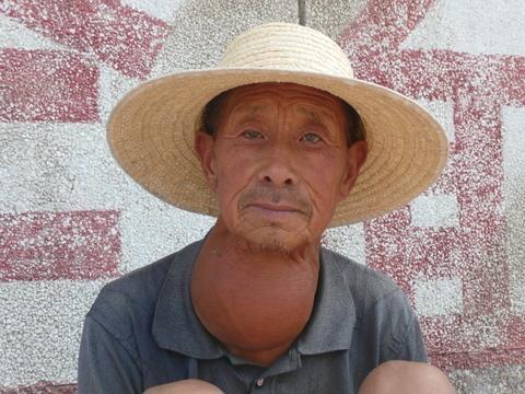 67嗓子不舒服居然是脖子上长了肿瘤这个案例需要大家引起重视