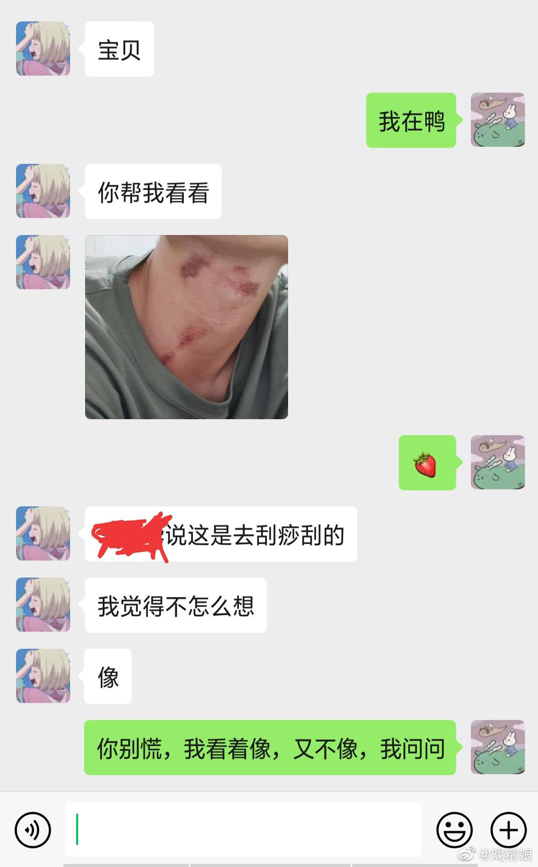 请问这是刮痧还是吻痕