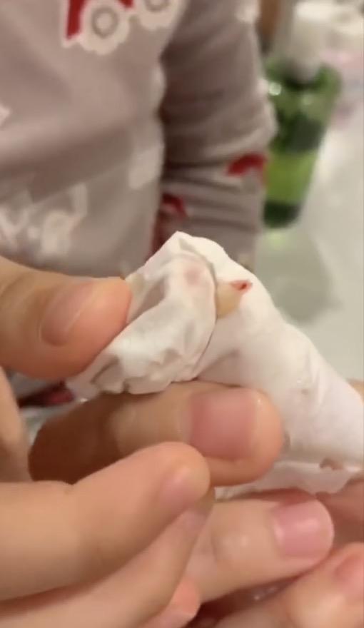 爸爸不敢拔 妈妈动作娴熟 neinei看好戏|吴尊|拔牙|乳牙_新浪新闻