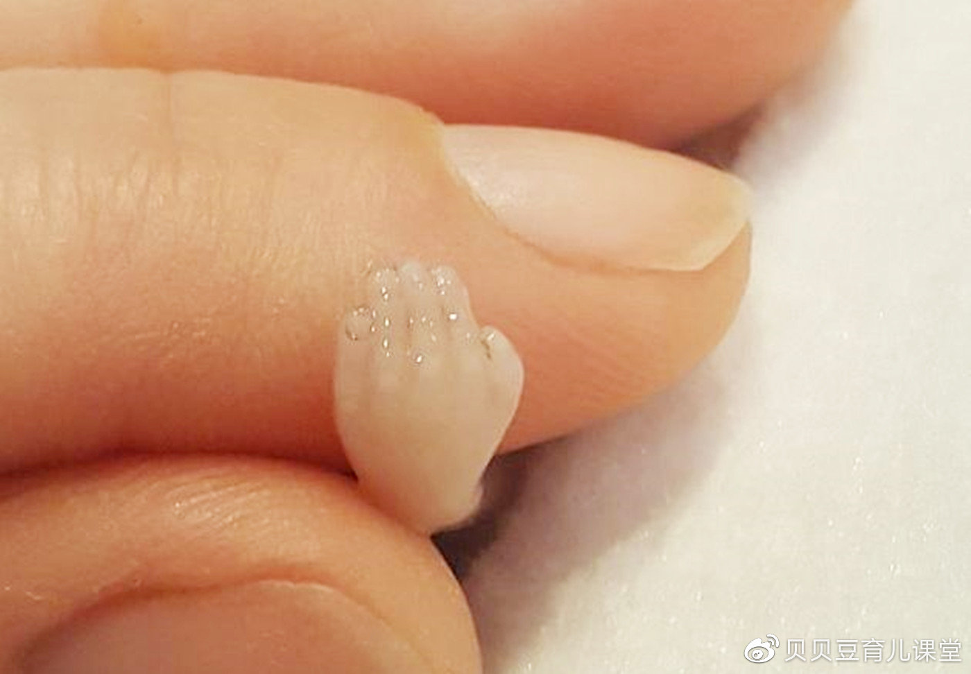 孕龄到了这个月别轻易打掉ta,14周胎儿的实拍图,愿你能善良