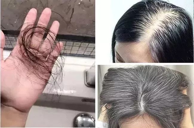 却越抓越痒,小包,血痂此起彼伏一撩头发,却沾满了一手的油脂一甩头发