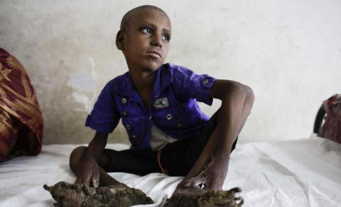 男子身上居然长出树枝,还活的好好的,网友:这是聊斋吗?