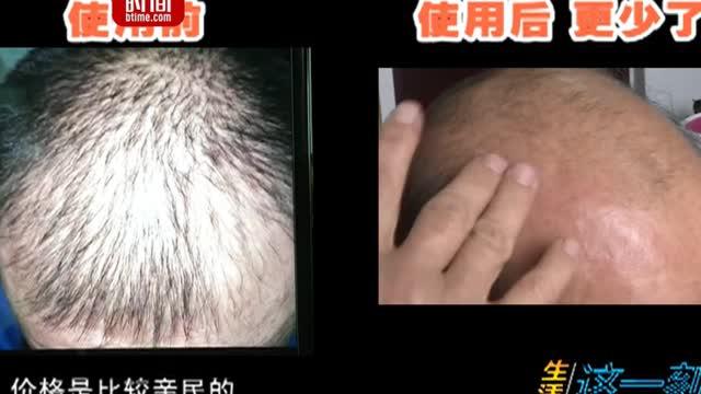 古方生发液:生发液号称4个月有效 脱发男子用5个月后头发掉光