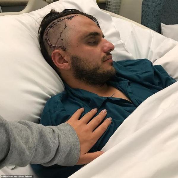 澳洲男子患晚期脑癌活不到一年放弃化疗改吃素食竟成功治愈癌症