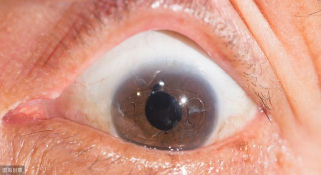 糖尿病眼部病变要小心4大要点要做到常喝1款茶对眼睛好