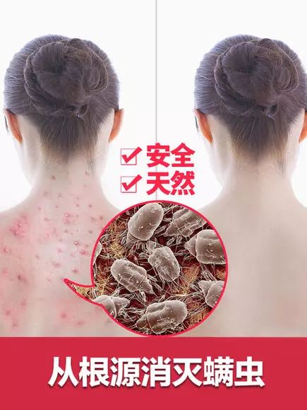 不到2毛钱的神器,一放就能让99%螨虫"集体自杀"!