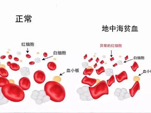 携带地贫基因?家长应该了解什么?