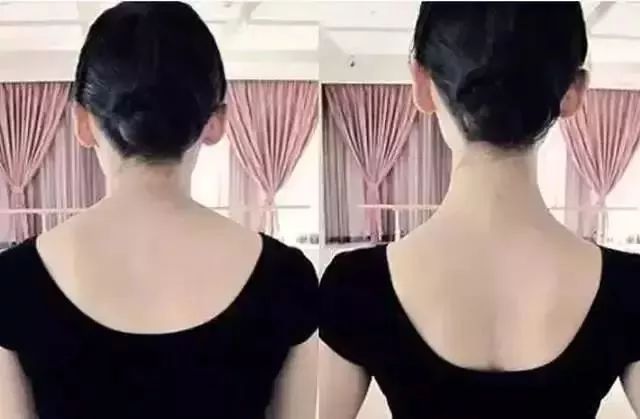 含胸驼背太显老!穿上它,1秒提胸挺背,塑造