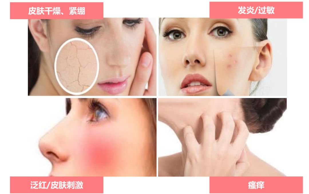 长期破坏这道屏障,你的脸就像被戳了好多个洞的筛子,水分蒸发速度加快