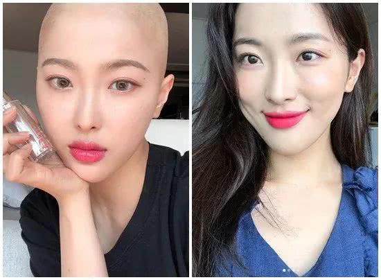 美女网红患癌后剃光头纪念抗癌路男友哭泣我会每天亲你的头