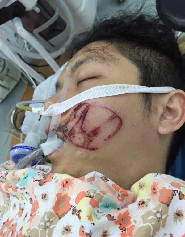 驾驶本田被安全气囊炸脸,看到车主后,网友:一日本田终身本田