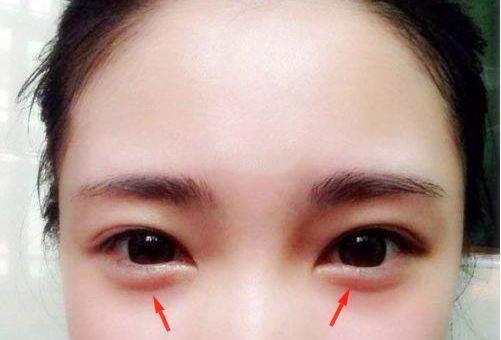 眼下有卧蚕,主福寿,生贵子.