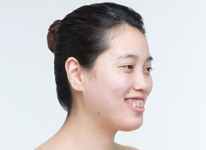 嘴凸到能"耕地"的她用12小时整成翻版baby,刚红就劈腿?