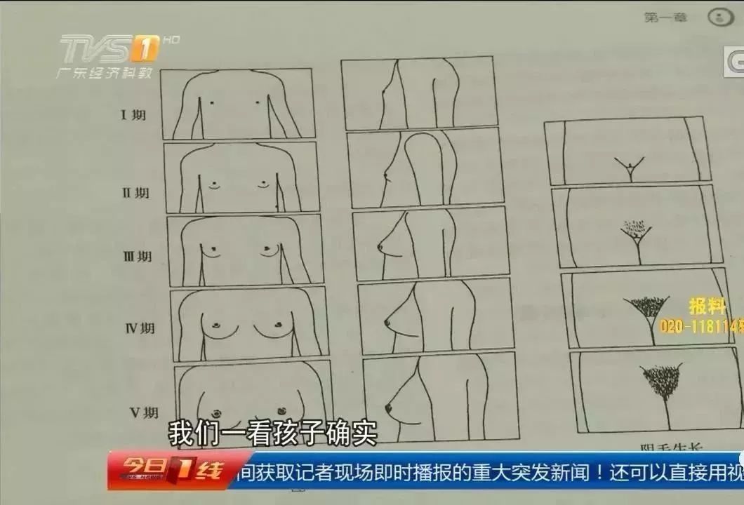 7岁女孩爱吃炸鸡致性早熟这些食品正在危害孩子的健康
