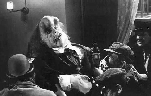 头围91厘米的传奇"象人":坐着睡觉跳着赚钱,躺下就会窒息死亡