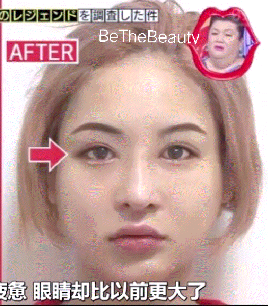 花2000万也没整成明星，那些整容没变很美的人错在哪？|热巴|广濑|瞳距_新浪新闻