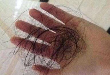 齿科大学和东京大学的研究人员发现了衰老过程中头发稀疏和脱落的原因