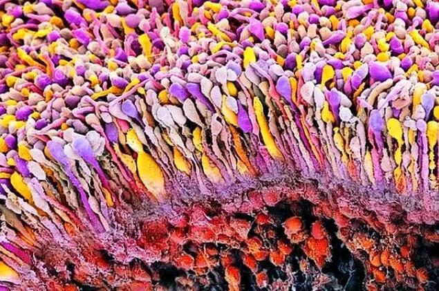 电子显微镜下拍摄的人体微观世界,猜猜它们属于身体的哪些部位