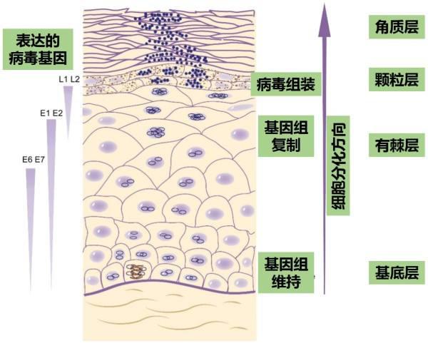 宫颈癌的发病原因和主要传播途径|宫颈癌|发病|感染者_新浪新闻