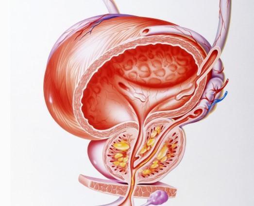 第一处,前列腺大