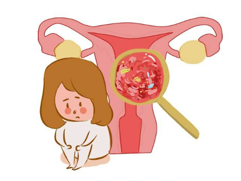 有的女性朋友月经量过多或者过少,周期不准,说明子宫功能可能存在异常