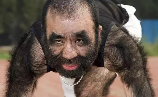 "中国第一毛孩"结婚了,曾遭受歧视几近自杀,历任女友皆是美女