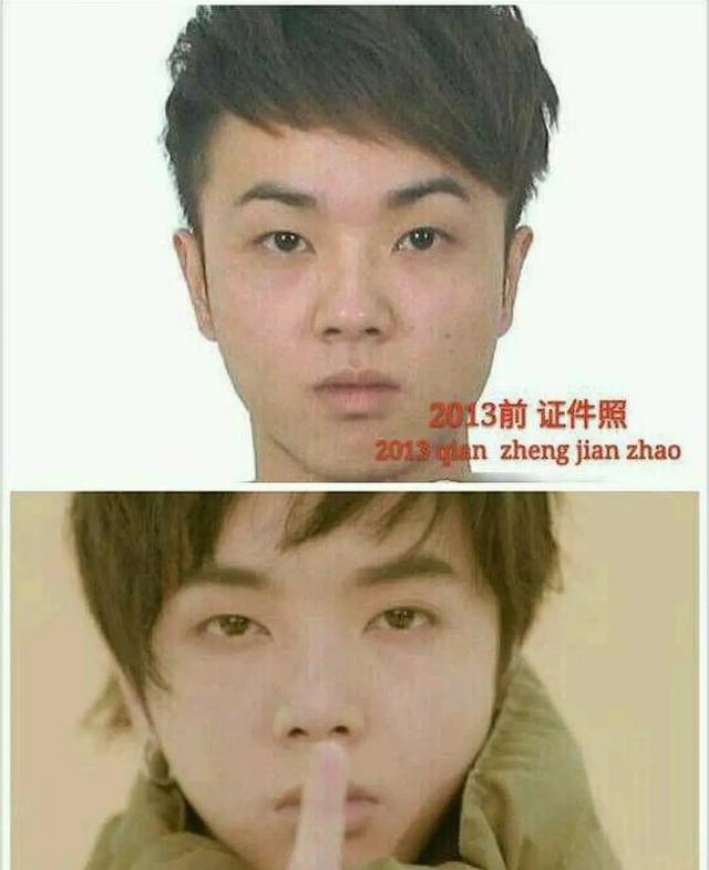华晨宇一年一个样整容上瘾了