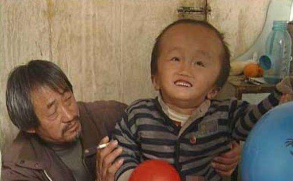 当年那些喝了三鹿奶粉的大头娃娃现在是什么样子