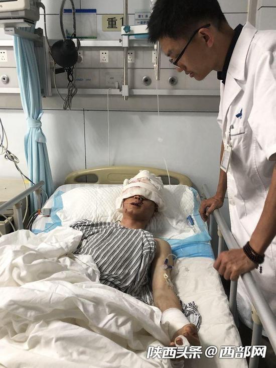 西安交通大学第一附属医院整形美容•颌面外科主治医生余学元正在检查王某受伤的手臂。