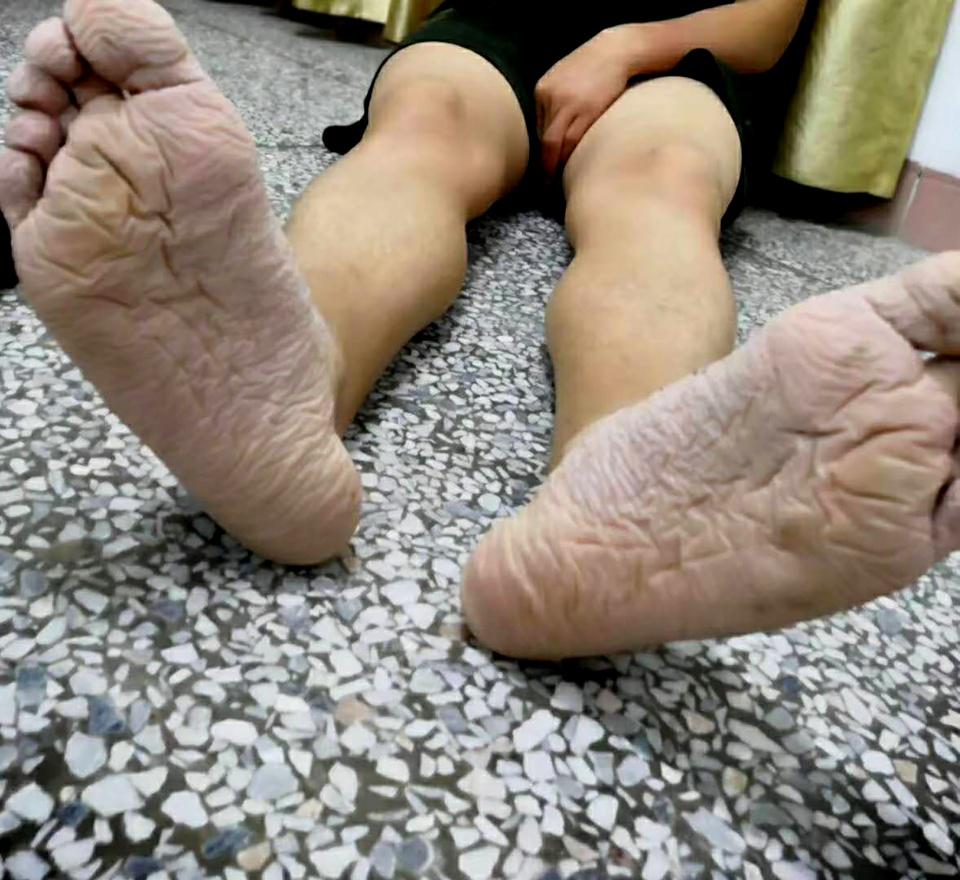 他这双发白,褶皱,浮肿变形的大脚,已经在水里陆陆续续连续泡了4天.