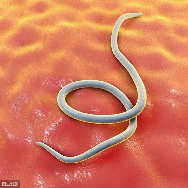 肛周瘙痒难捱,祸首就是这几样,如此处理,解脱挠痒尴尬|大便|肛门|蛲虫