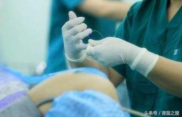 分娩前,要刮毛,很多孕妈表示很无奈