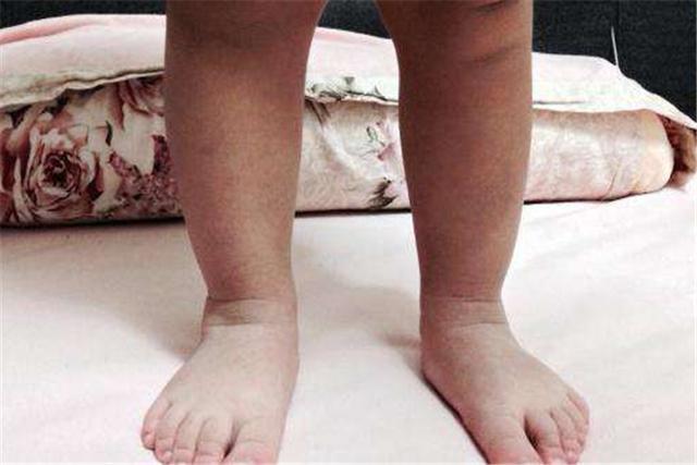 宝宝走路总摔跤外八字脚让妈妈担忧都是7个月时惹的祸